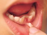 Đừng vội vứt răng sữa của con đi vì chúng có thể cứu mạng bé khi trưởng thành-3