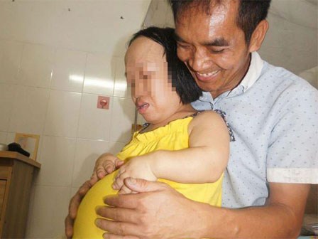 Bất chấp nguy hiểm, người phụ nữ cao 91cm như đứa trẻ lên ba mang bầu vượt mặt