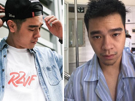 Minh chứng khủng khiếp của sốt xuất huyết: sau 1 tuần cơ thể 