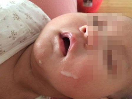 Bé 3 tháng ngủ sâu li bì, không thức giấc sau khi bú sữa mẹ ngấm cồn