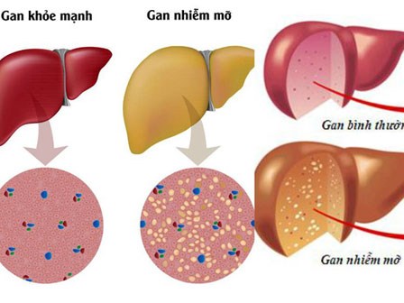 15 tuổi đã bị 