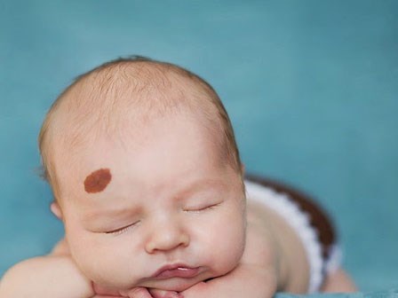 Điểm mặt 7 dấu hiệu nguy hiểm cảnh báo bé cần đi gặp bác sĩ ngay lập tức