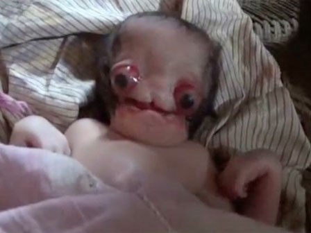 Sinh con tại nhà, bố mẹ thất kinh khi đứa bé ra đời mang gương mặt người ngoài hành tinh