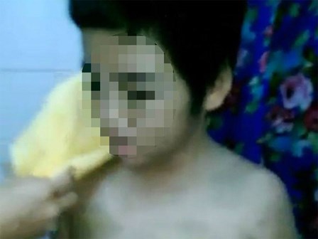 Giải cứu bé trai ở miền Tây bị mẹ và dì bạo hành dã man