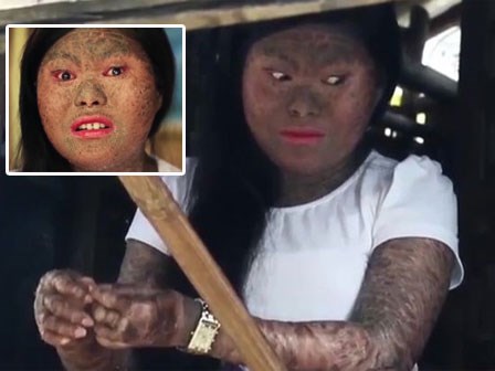 Những người mắc bệnh lạ đến y học cũng phải 'bó tay' chữa không nổi