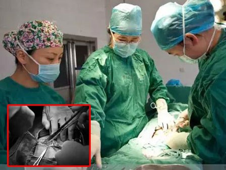 Khi đau đẻ ai cũng đòi mổ nhưng mẹ có biết một ca sinh mổ đau đớn thế nào không?