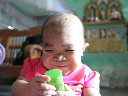 Cô gái 28 tuổi vẫn mang hình hài của đứa trẻ lên 3, lẫm chẫm tập đi từng bước-5