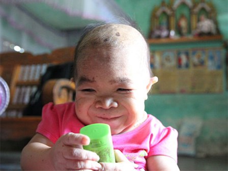 Cô gái gần 30 vẫn mang hình hài của đứa trẻ 2 tuổi: Lủi thủi trong nhà cả đời, không có bạn cùng chơi