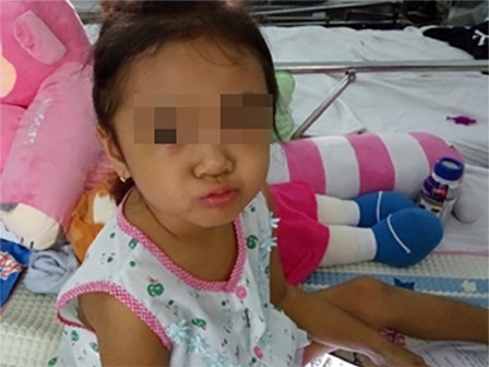 Kì lạ: Bác sĩ hi vọng khối u của bệnh nhi là u ác tính