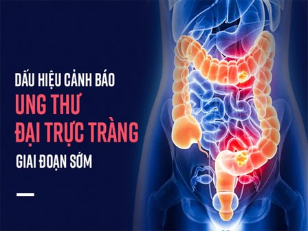 Nếu sáng ngủ dậy đau bụng hoặc có triệu chứng sau, bạn nên khẩn trương đi khám ung thư