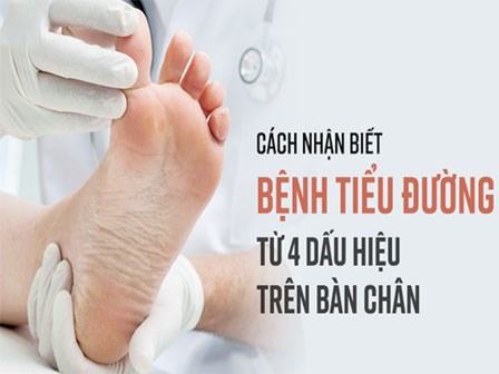 Khi có 4 dấu hiệu này ở bàn chân, có thể bạn đã rơi vào 