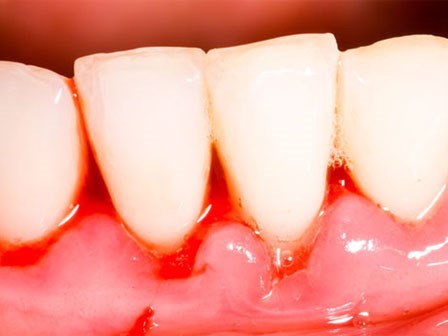 Phát hiện sớm ung thư rất quan trọng: 8 dấu hiệu cần phải cảnh giác ngay, đừng để quá muộn