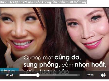 Đau đớn, hoại tử... sao Việt kêu trời vì phẫu thuật thẩm mỹ 'quá tay'