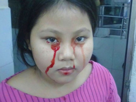 Xót cảnh 3 đứa trẻ bị chảy máu miệng, vợ chồng nghèo ngược xuôi lo cho con bị nói là dựng chuyện lừa đảo