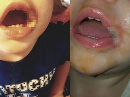 Để con nhỏ 19 tháng tuổi nghịch sạc điện thoại, khi người mẹ phát hiện ra thì đã quá muộn
