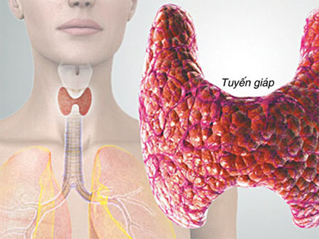 Bác sĩ Cần Thơ kịp thời phát hiện 1 trẻ sơ sinh mắc phải căn bệnh nếu chẩn đoán chậm trẻ sẽ vĩnh viễn bị thiểu năng trí tuệ-4