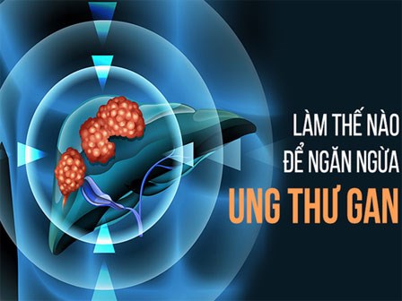 Giáo sư đầu ngành chia sẻ 6 bí quyết chăm sóc gan: Đừng để ung thư