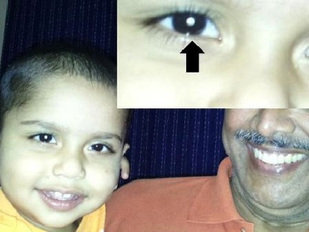 Chụp ảnh cho con phát hiện bệnh ung thư hiếm gặp