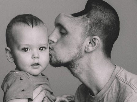 Nghiện nước tăng lực, người đàn ông mất hẳn nửa bộ não và suýt không giữ được mạng để gặp con đầu lòng