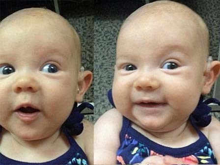 Tổng hợp khoảnh khắc khi các em bé khiếm thính lần đầu được nghe giọng nói