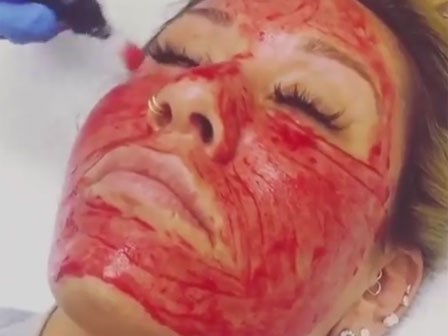 Phương pháp làm đẹp