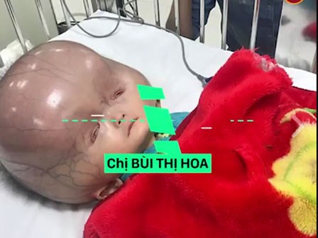 Bé trai não úng thủy bị bố bỏ rơi khi mới lọt lòng