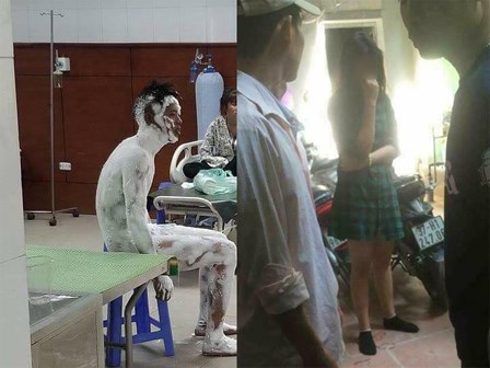 Vụ nam thanh niên bỏng toàn thân: Tẩm xăng tự thiêu do người yêu đòi chia tay