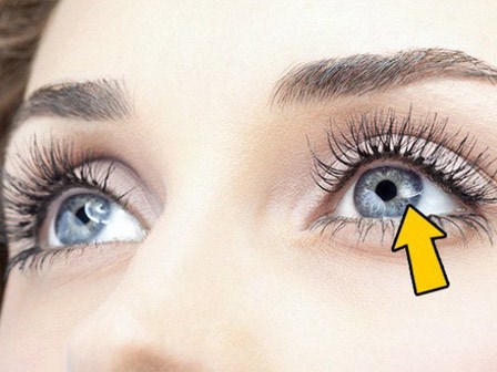Có thể bị mù vĩnh viễn nếu mắt có dấu hiệu này mà mặc kệ không đi khám
