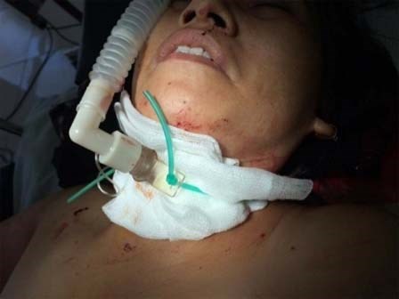 Nam thiếu niên cứa cổ chủ tiệm tóc vì hiếp dâm không thành