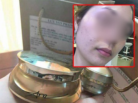 Khách hàng từng là đại lý của TS Group tố bị mẩn ngứa khi dùng sản phẩm: 