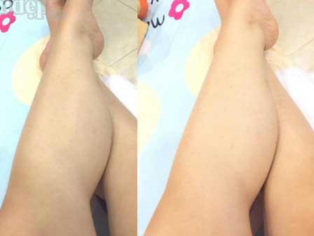 Tắm trắng tại nhà an toàn dễ dàng từ nguyên liệu tự nhiên-11