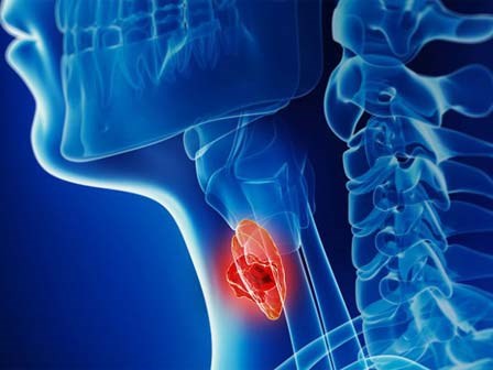 Căn bệnh ung thư tiến triển nhanh, ăn uống khó: Dấu hiệu cần biết để điều trị