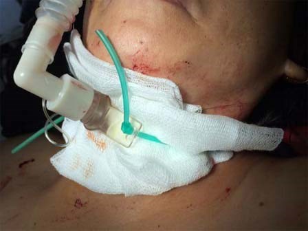 Vụ bà chủ tiệm tóc bị cắt cổ: Gây án xong, nghi phạm bình thản đi nghe ngóng