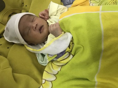 Nhỏ sữa chữa đau mắt, mẹ chết lặng vì con thủng giác mạc, nổi bong bóng mắt