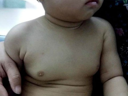 Nam thanh niên ngực bỗng to lên mỗi ngày vì dùng ké mỹ phẩm của bạn gái-2