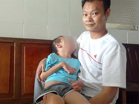 Sốt cao, giảm 10kg liên tục cô giáo trẻ choáng váng khi biết mắc căn bệnh lây qua nước bọt-3