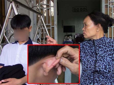Lý sự của mẹ kế thích đánh con chồng là đánh ở Tây Ninh