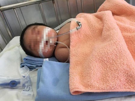 Bác sĩ chia sẻ câu chuyện: Mẹ tự tay