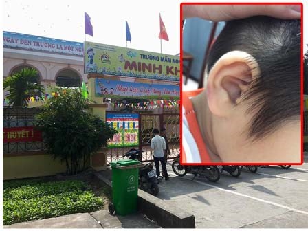 Mẹ kế bạo hành con riêng của chồng lên tiếng: