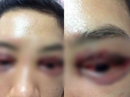 Vụ cô gái đi cắt mí mắt gây xôn xao MXH: Khi cô gái đến làm việc, chủ spa hỏi sao lại bêu xấu hình ảnh spa?