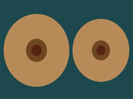 Tại sao ngực chị em phụ nữ lại bên to bên nhỏ?