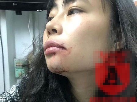 Uber lên tiếng việc nữ hành khách ở Hà Nội bị tài xế đánh 'bầm mặt, chảy máu'