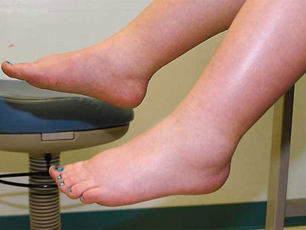 Tưởng đau bụng do bị bệnh dạ dày, mẹ không ngờ lại là hội chứng nguy hiểm khiến con gái ra đời sớm 2 tháng-12