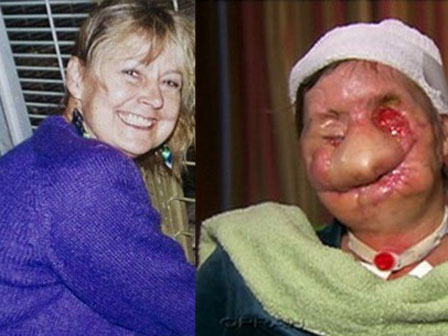 Tinh tinh thoát khỏi chuồng tấn công người trong công viên-1