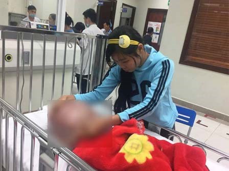 Bé trai 13 tháng tuổi đầu căng mọng vì mắc não úng thủy đã qua đời