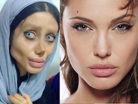 Cô gái phẫu thuật thẩm mỹ hơn 50 lần đề nhìn giống Angelina Jolie, kết quả trả về gia tinh Dobby