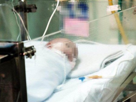Bé gái sinh non ở tuần 24 thai kỳ, chỉ nặng 660 gram thoát khỏi lưỡi hái “tử thần”