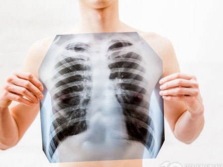 4 nhóm nghề nghiệp có nguy cơ mắc ung thư phổi cao nhất, hãy cảnh giác để phòng tránh sớm