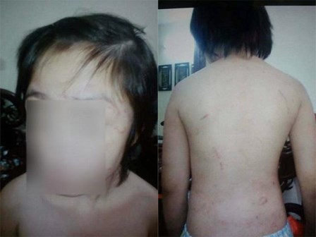 Mẹ bé trai 10 tuổi bị bố và mẹ kế bạo hành: “Khi gặp tôi không nhận ra con”