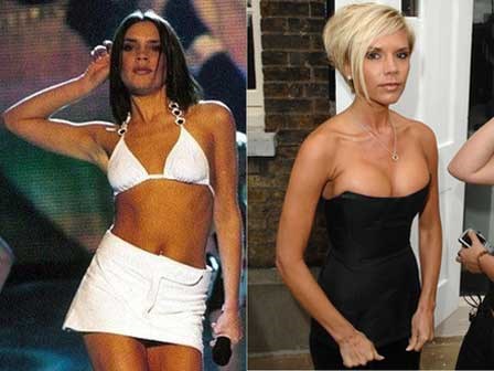 Phẫu thuật ngực tới 4 lần, Victoria Beckham thừa nhận đây là việc làm khiến cô hối hận